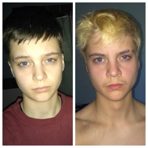 albums 98 pictures ftm before and after testosterone pictures excellent