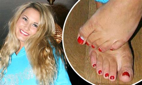 The Only Way Is Essex Star Sam Faiers Shows Off Blister Along With Toe
