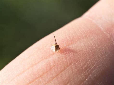 See training schedules for beginners and experienced runners. Bee Sting Home Remedy