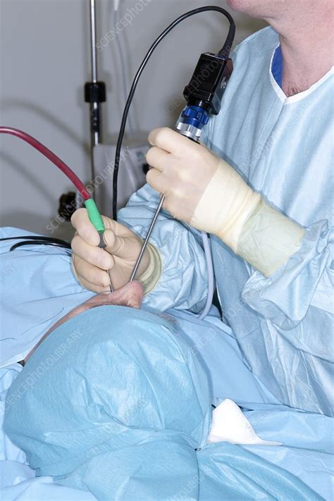 Nasal Polyp Surgery Stock Image C0087843 Science Photo Library