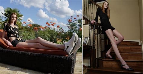 Texas Teen Breaks Guinness World Record For Having Worlds Longest Legs