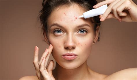 Simple Ways To Get Rid Of Pimple Marks