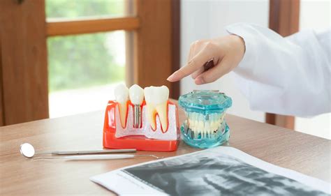 Dental Implants Learning Center — Monroe Dental Arts