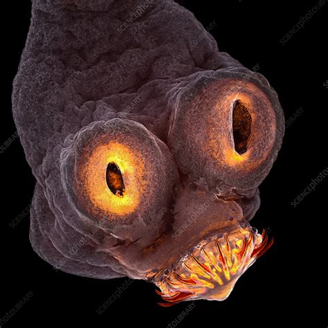 Tapeworm Taenia Solium Stock Image C0434113 Science Photo Library