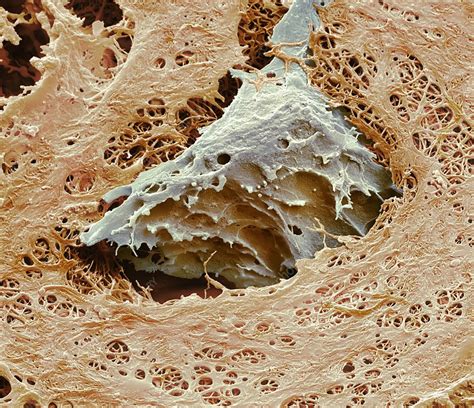 Nasal Cartilage Sem Stock Image C Science Photo Library
