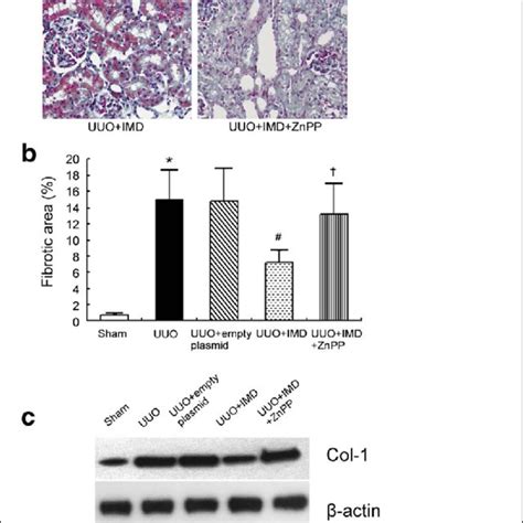 Imd Inhibits Renal Fibrosis Induced By Uuo By Induction Of Ho A