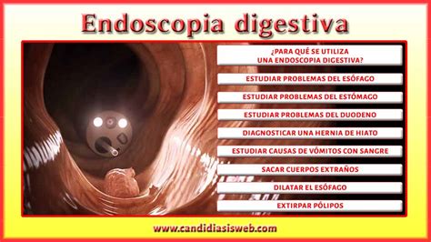 Pruebas Y Examenes Endoscopia Digestiva 14508 The Best Porn Website