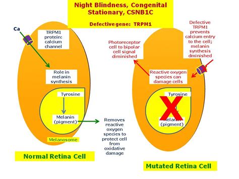 Night Blindness Congenital Stationary Csnb1c Hereditary Ocular Diseases