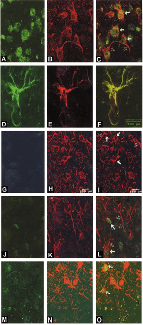 Indirect Immunofluorescence Labeling And Confocal Micrographs Of