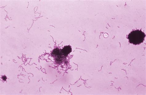 Public Domain Picture Streptococcus Mutans Gram Stain Id