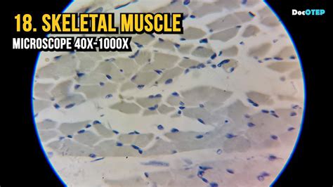 Skeletal Muscle Tissue Slide 100x