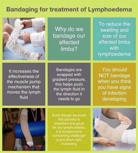 What Is A Lymphedema Pump Clayburg Wulfing