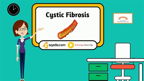 Cystic Fibrosis Animation Videos Medical Pathology Student V