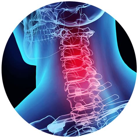 Whiplash Symptoms And Advanced Spine Care