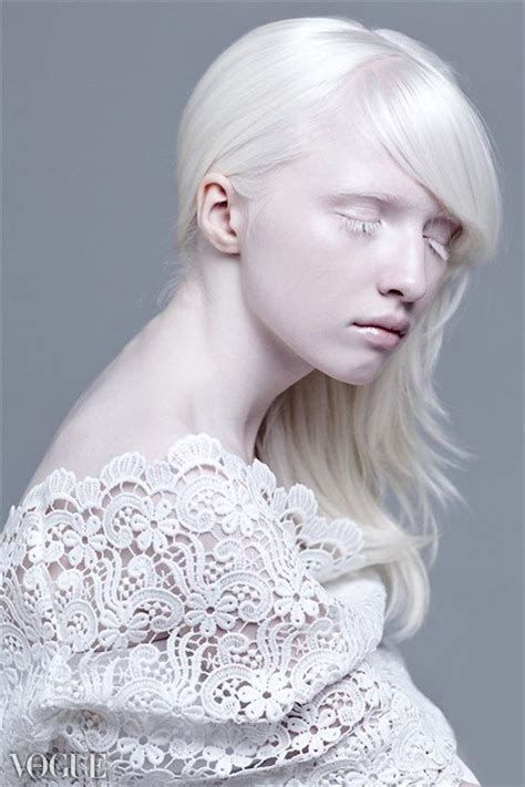 Nastya Kiki Zhidkova Albino Model Albinism White Makeup