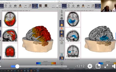 Proof That Wearable Neurotech Works Proof By Voxxlife Hpt Team