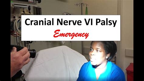 Cranial Nerve VI Palsy Emergency YouTube
