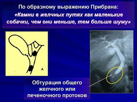 Диета при механическая желтуха Механическая желтуха - презентация онлайн Механическая желтуха - презентация онлайн Диета при механическая желтуха