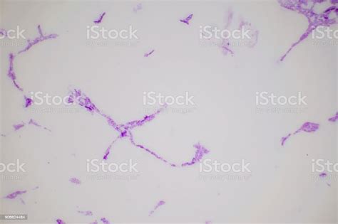 Bacteria On Slide Under The Microscope Constitute A Large Domain Of