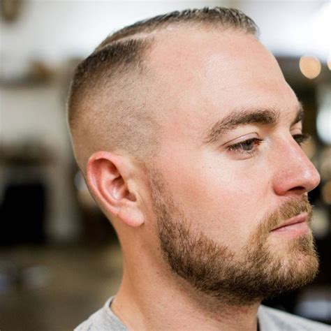 25 Marvelous Hairstyles For Balding Men Hottest Haircuts