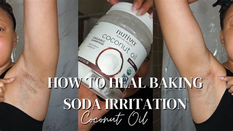 How To Heal Baking Soda Underarm Burn Euniycemari Youtube