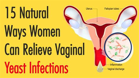 Natural Ways Women Can Relieve Vaginal Yeast Infections Free