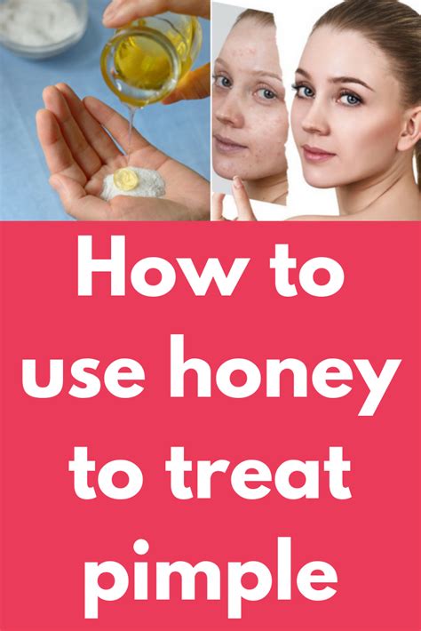 How To Treat Acne Using Honey Howtoremvo