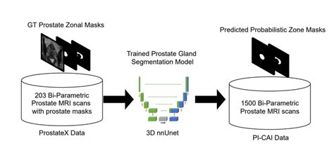 Prostate Gland Segmentation Model Download Scientific Diagram