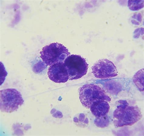 Filemast Cell Tumor Cytology 2 Wikipedia The Free Encyclopedia
