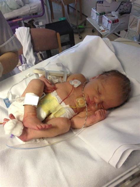 Preemie Miracles Parents Share Their Premature Babys Story Babycenter