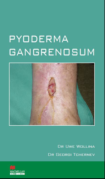 Pdf Pyoderma Gangrenosum Pathogenesis