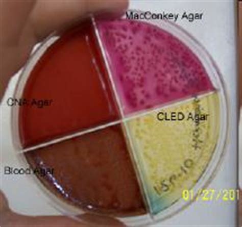 Used to specifically grow gram positive organisms such as staphylococci, streptococci and enterococci. positiveplates