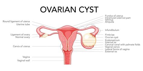 Infografis Anatomi Sistem Reproduksi Wanita Dengan Rahim Berlabel Dan