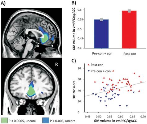 Increased Grey Matter In Those With Higher Levels Of Moral Reasoning