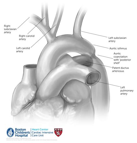 Bovine Aortic Arch Online Supplement