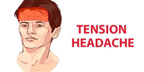 Tension Headache