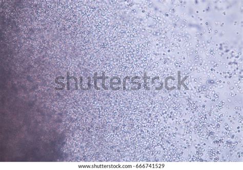 Budding Yeast Cell Under Microscope Stock Photo 666741529 Shutterstock