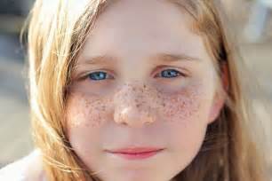 Photography Enhance The Freckles Sun Kissed Beauty Kiss Beauty Freckles Beauty