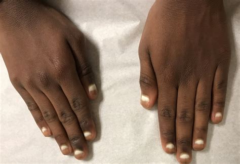 It makes an excellent meal or. Half-and-Half Nails | Consultant360