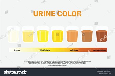 Illustration Urine Color Chart Stock Vector Royalty Free 2271912875