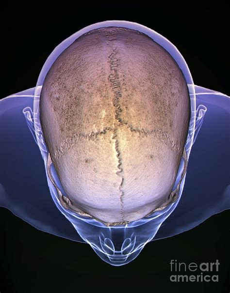 Skull Sutures 3d Ct Scan Photograph By Zephyr