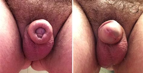 Who Has An Uncut Cock Page 2 Xnxx Adult Forum