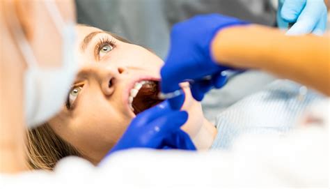 Cuidados Después De Una Extracción De Muela Boca A Boca Clínica Dental Majadahonda