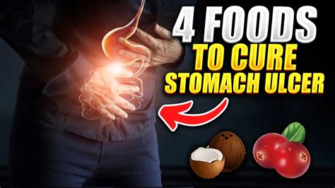 4 Foods To Cure Stomach Ulcer Youtube