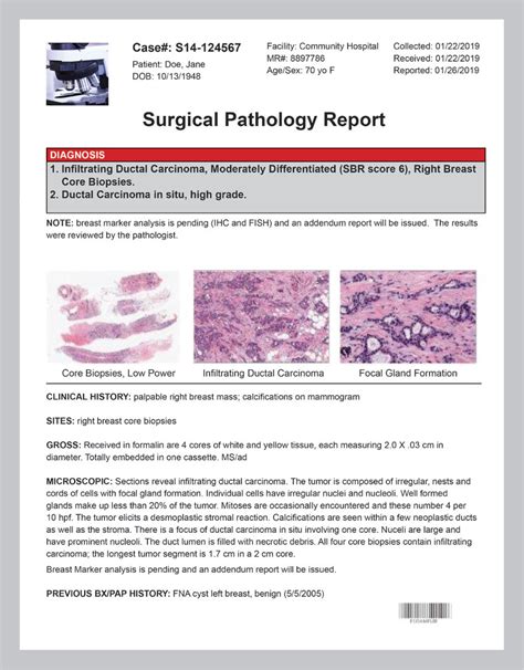 How To Read Your Pathology Report Your Pathologist