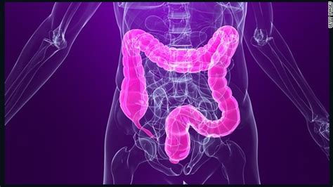Be Kind To Your Colon With Less Invasive Screenings Panel Advises