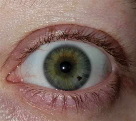 I Love My Eye Freckle Eyes