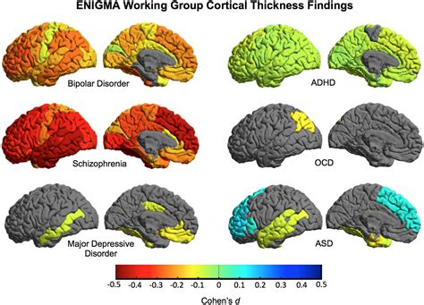 Human Brain Mapping Neuroimaging Journal Wiley Online Library