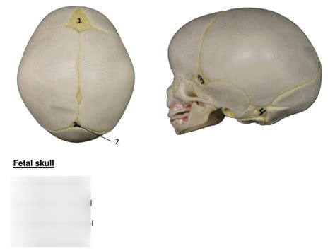 The Fetal Skull Anatomy Diagram Educational Poster Et