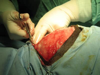 They play a larger role in your daily life pulling your shoulder blades back, he adds is not enough; Kathy's Dusty Trails: Monday Medicine & Surgery #1